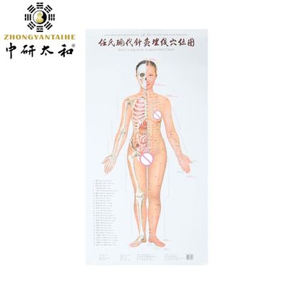 몸 자오선 침술 문화 현대 침술 및 임베딩 포인트