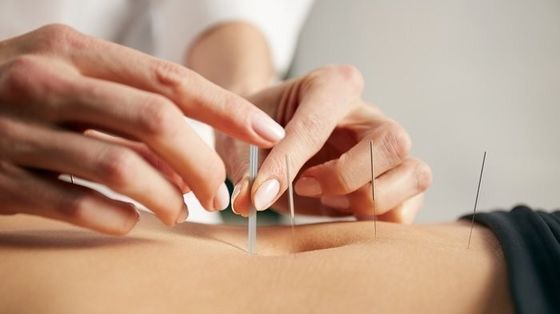 0통증 완화를 위한.16mm 실버 내피 침술 바늘