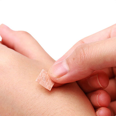 GB 2024-2016 침술 압착 바늘 0.2mm X 1.5mm (중의학 기기 속성 안전 표준)