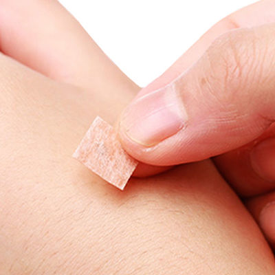 침술 바늘 패키지 개량 상자당 100개 압축 및 방출 삽입 방법 침술 압력 바늘